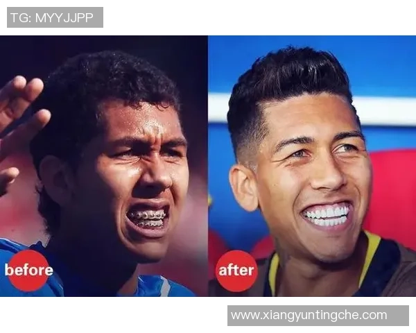 足球明星正畸全过程揭秘与精彩瞬间分享视频合集 足球明星正畸全过程揭秘与精彩瞬间分享视频合集